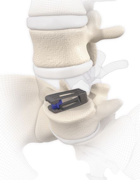 vertaconnect.d28dcd98.jpg